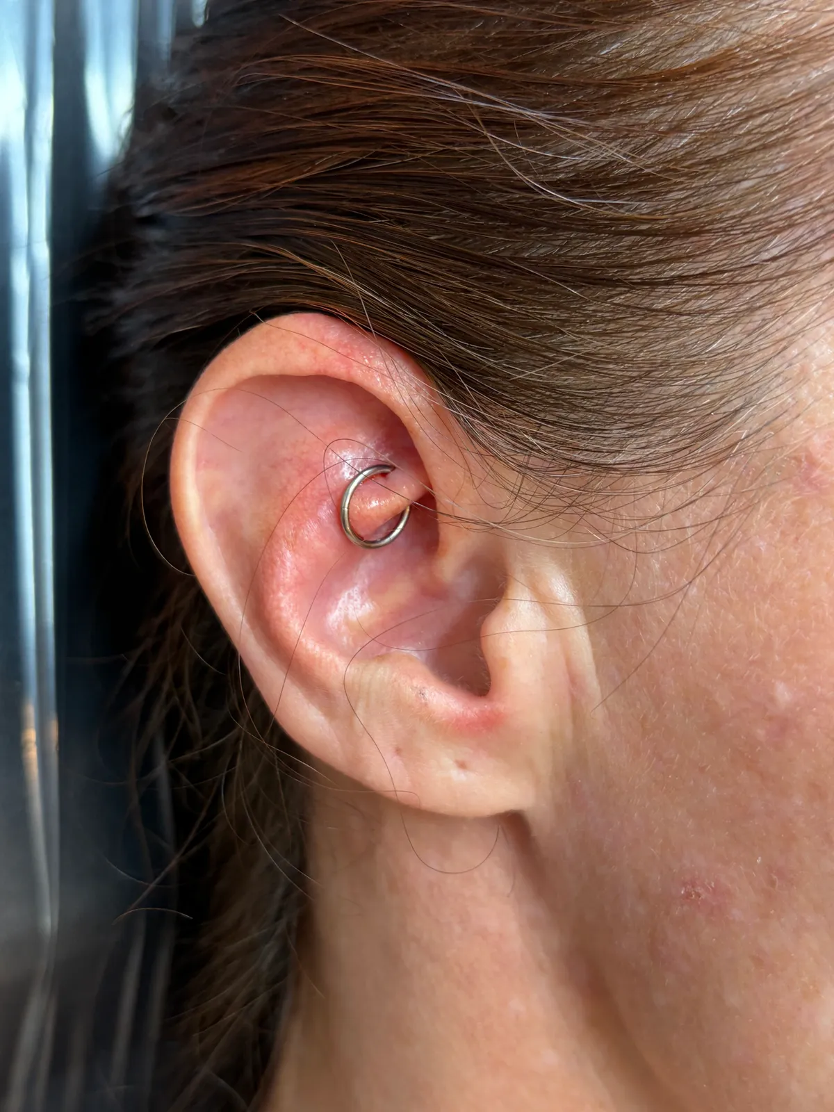A healed helix piercing with a slim seamless titanium hoop on the upper ear cartilage